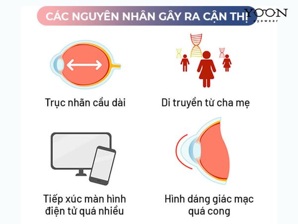 NGUYÊN NHÂN GÂY RA CẬN THỊ?