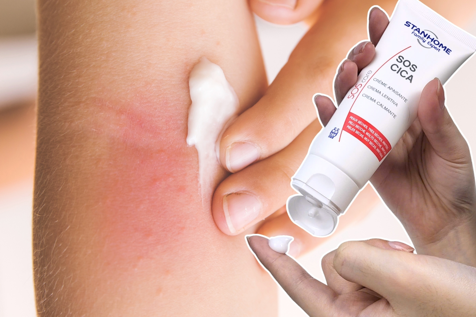 bôi thoa dưỡng ẩm phục hồ và cấp ẩm cho da