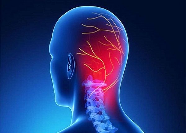 Hình ảnh minh họa cấu trúc não và ảnh hưởng từ cơn đau nửa đầu