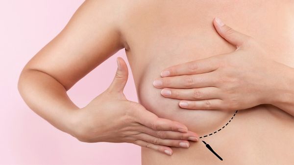 Massage và kéo núm ti bằng tay