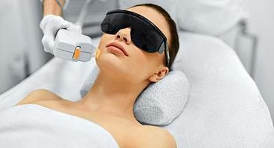 liệu pháp ánh sáng IPL