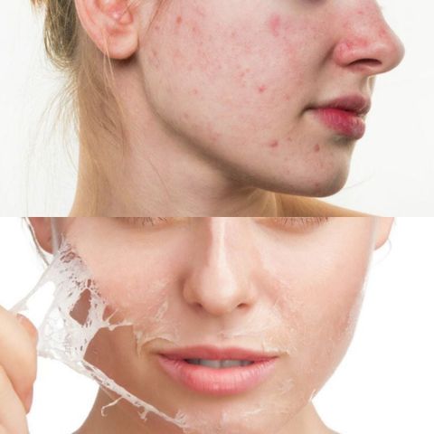 Top 8 Sản Phẩm Peel Da Tốt Nhất Hiện Nay 2024