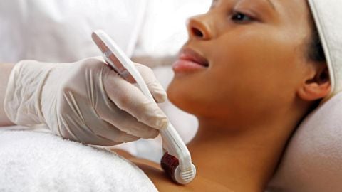 Microneedling Và PRP: Cặp Đôi Hoàn Hảo Trong Trẻ Hóa Da