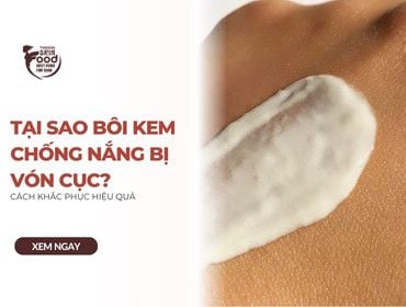 Tại sao bôi kem chống nắng bị vón cục? Cách khắc phục hiệu quả