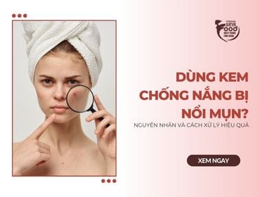 Dùng kem chống nắng bị nổi mụn? Nguyên nhân và cách xử lý HIỆU QUẢ