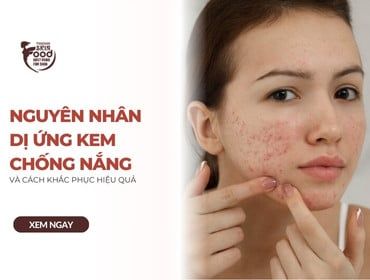 Nguyên nhân dị ứng kem chống nắng và cách khắc phục hiệu quả