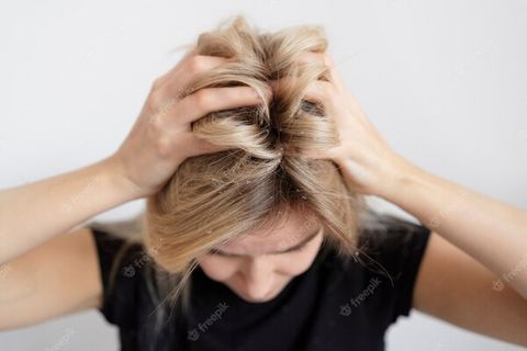 Khám Phá Top 05 Dầu Gội Trị Gàu Hiệu Quả Và Lấy Lại Mái Tóc Khỏe Mạnh