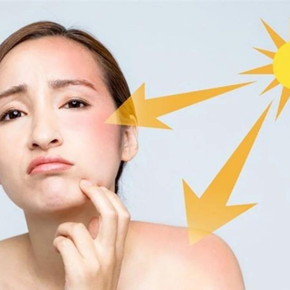 30.3 - thegioiskinfood.com - Có được bôi kem chống nắng trực tiếp lên da