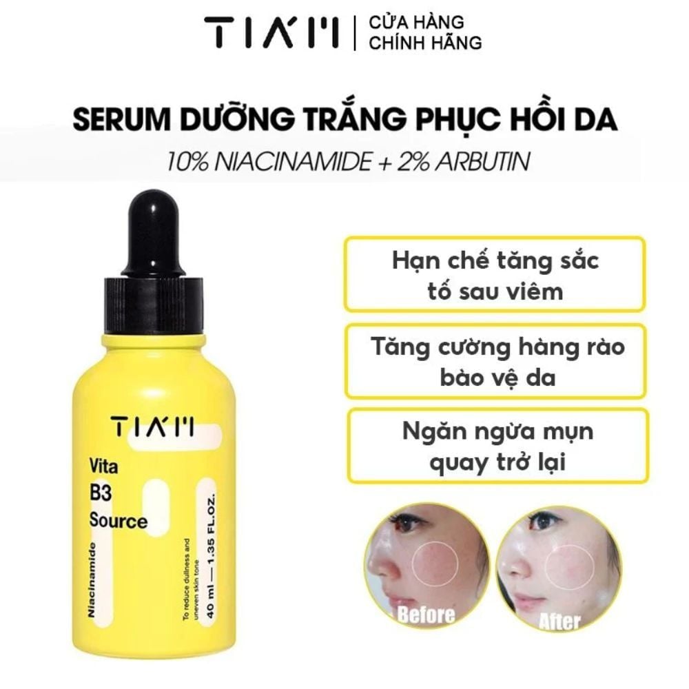 serum dưỡng trắng phục hồi da mụn Tiam Vita B3 Source