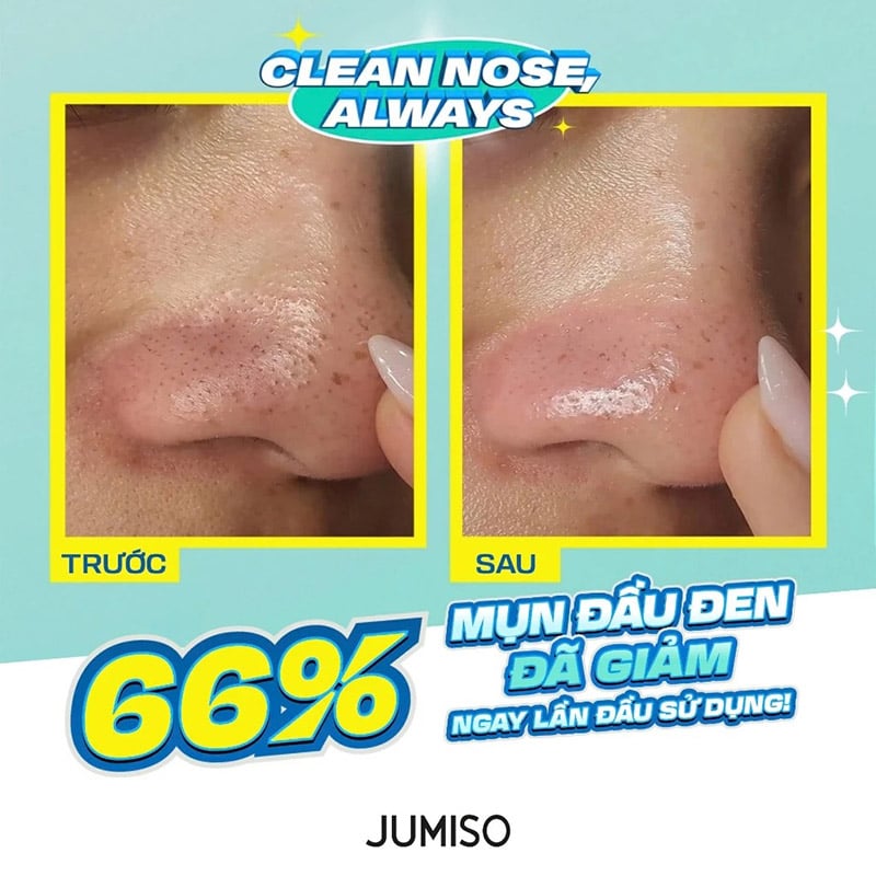 thegioiskinfood.com - Dung Dịch Làm Mềm Mụn Đầu Đen Jumiso Blackhead Melting Softener 150ml