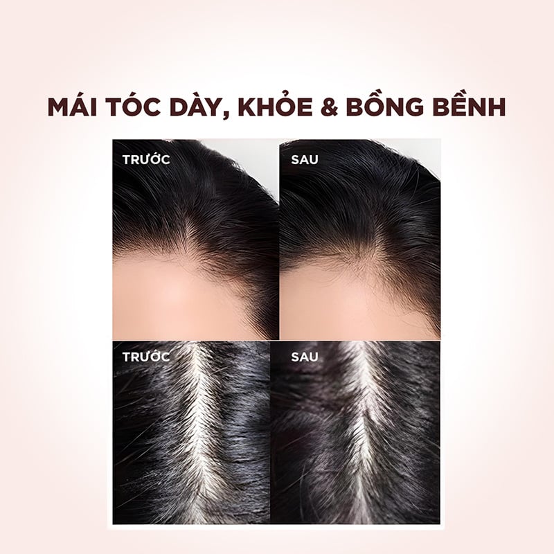 thegioiskinfood.com - Dầu Gội, Dầu Xả Giảm Rụng Tóc, Giúp Tóc Chắc Khỏe L'oreal Full Resist 440ml
