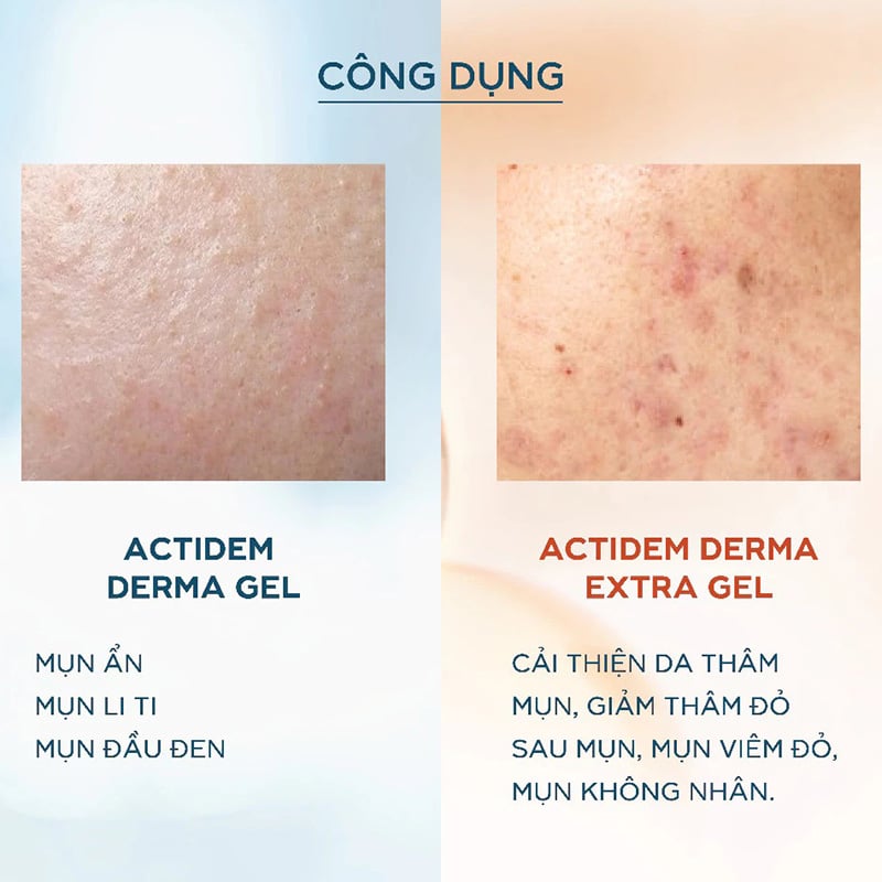 thegioiskinfood.com - Gel Giảm Mụn, Mờ Thâm Actidem Derma Gel 18g