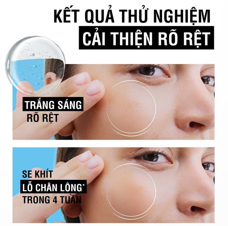 Serum Dưỡng Ẩm, Hỗ Trợ Dưỡng Sáng Da Neutrogena Hydro Boost Niacinamide Serum 30ml