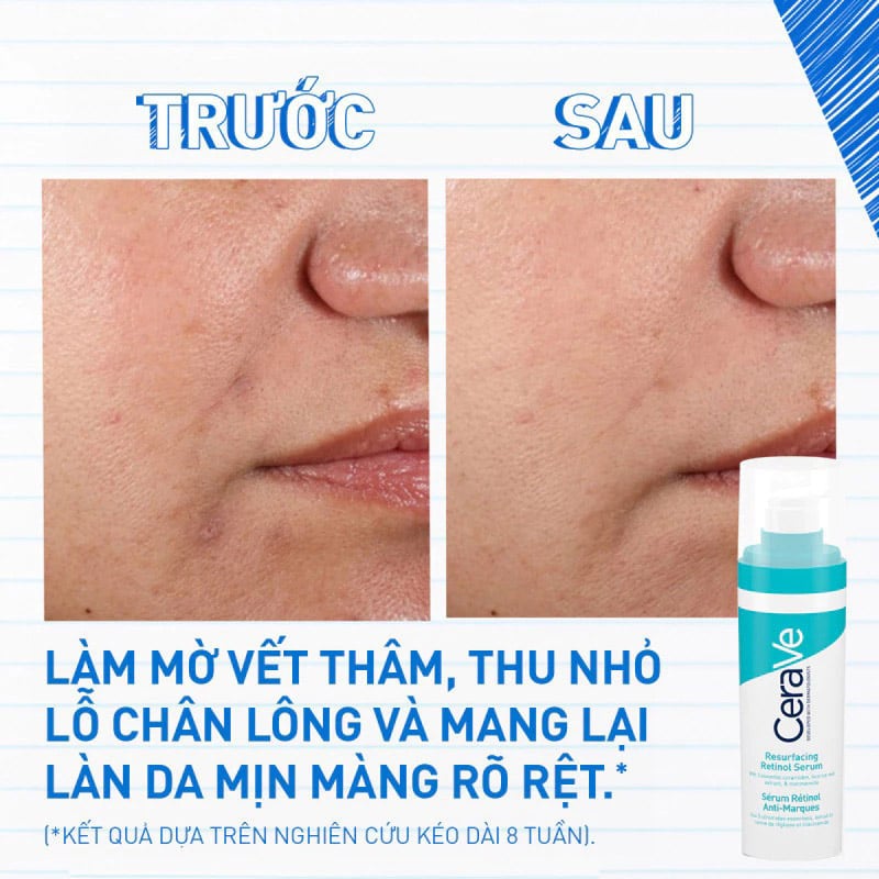 thegioiskinfood.com - Serum Cerave Giúp Hỗ Trợ Mờ Thâm Mụn Resurfacing Retinol Serum 30ml