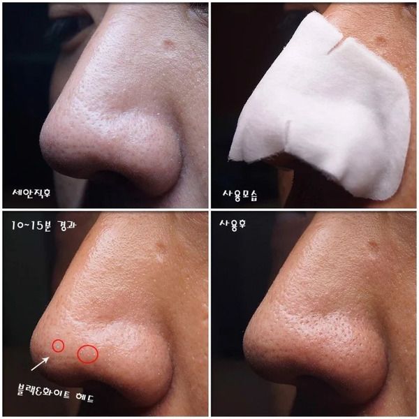 miếng dán Ciracle Blackhead Cotton Mask