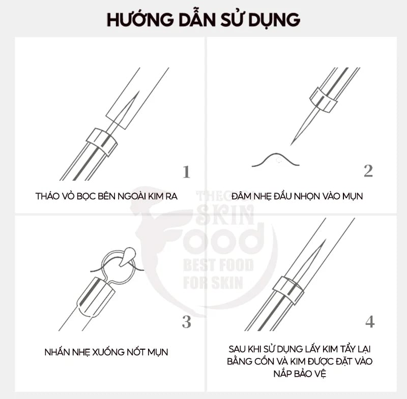 Cây Nặn Mụn Hai Đầu LMLTOP Acne Needle