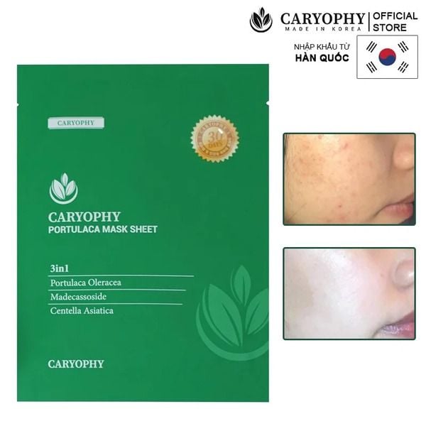 Caryophy Portulaca Mask Sheet giúp làm dịu da mụn, kháng khuẩn