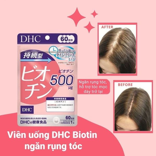 Viên uống ngăn rụng tóc, kích thích mọc tóc DHC Sustained Release Biotin