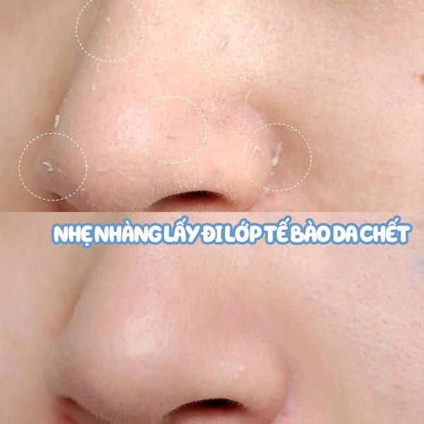 Tẩy da chết Rosette xanh sử dụng đơn giản