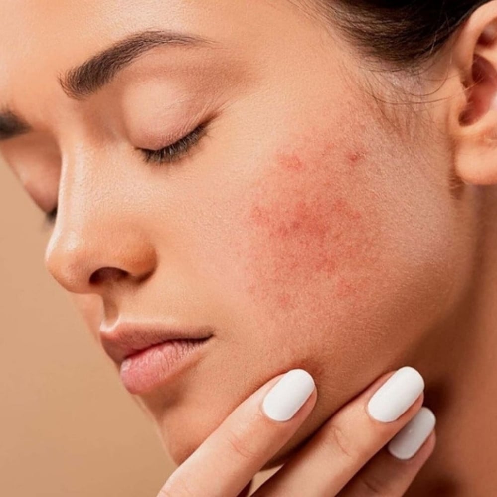 26.9 - thegioiskinfood.com - Đối tượng nào có thể thực hiện treatment da trong skincare