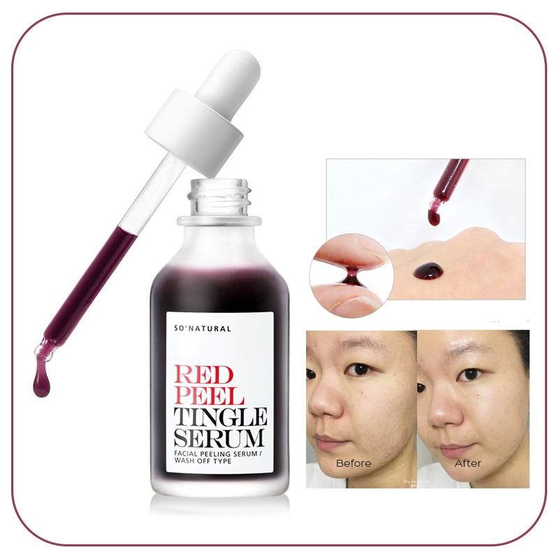 Tinh Chất Tẩy Da Chết Hóa Học So' Natural Red Peel Tingle Serum 35ml - An Beauty Shop