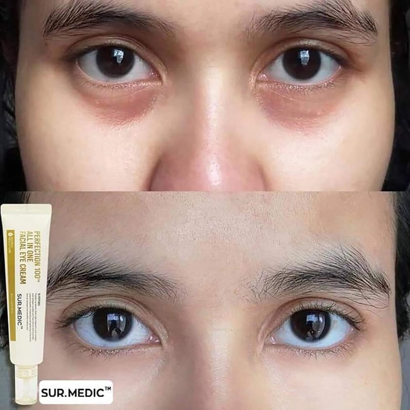Kem Dưỡng Cải Thiện Nếp Nhăn, Hỗ Trợ Dưỡng Sáng, Mờ Thâm Vùng Mắt Sur.Medic Perfection 100™ All In One Facial Eye Cream 35ml