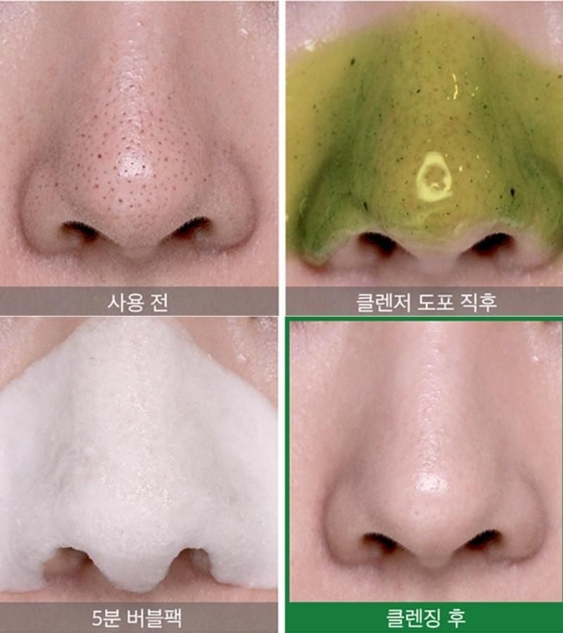 Sữa Rửa Mặt Sủi Bọt Hỗ Trợ Cải Thiện Mụn Đầu Đen Some By Mi Bye Bye Blackhead 30 Days Miracle Green Tea Tox Bubble Cleanser 120g