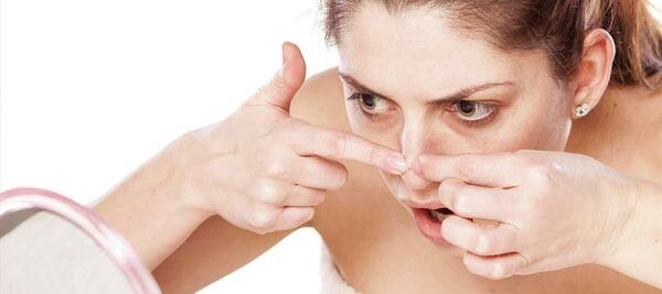 Thực hiện việc nặn mụn một cách nhẹ nhàng để tránh gây tổn thương cho da
