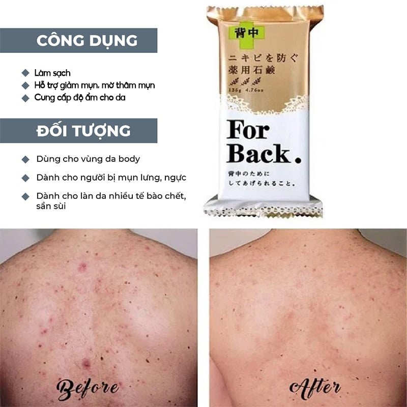 Xà phòng trị mụn lưng For Back Medicated Soap – Shop