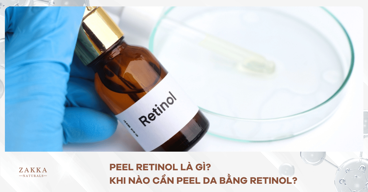 Peel Retinol Là Gì? Khi Nào Cần Peel Da Bằng Retinol?