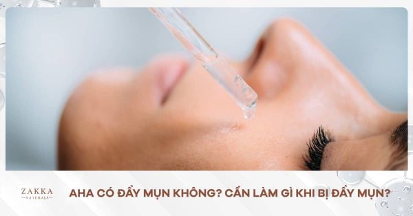 AHA Có Đẩy Mụn Không? Cần Làm Gì Khi Bị Đẩy Mụn?