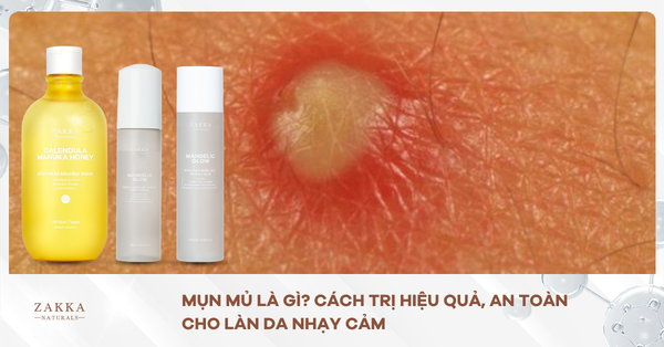 Mụn Mủ Là Gì? Cách Trị Hiệu Quả, An Toàn Cho Làn Da Nhạy Cảm
