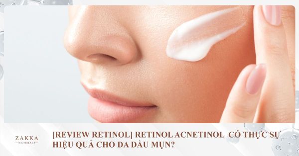 [Review Retinol] Retinol Acnetinol Có Thực Sự Hiệu Quả Cho Da Dầu Mụn?