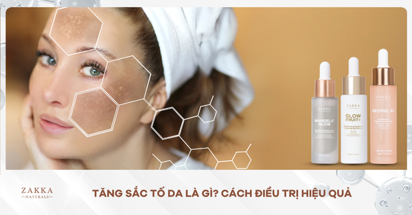 Tăng Sắc Tố Da Là Gì? Cách Điều Trị Hiệu Quả