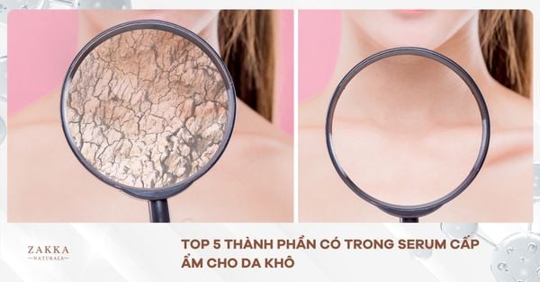 Top 5 Thành Phần Có Trong Serum Cấp Ẩm Cho Da Khô