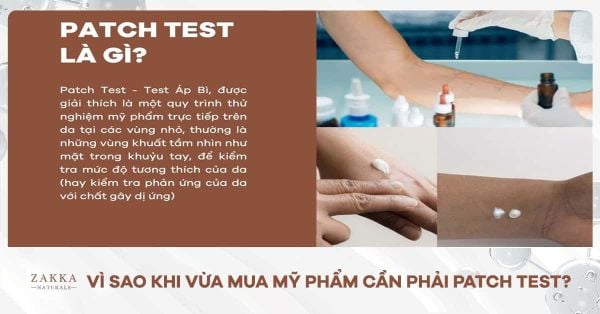 VÌ SAO KHI VỪA MUA MỸ PHẨM CẦN PHẢI PATCH TEST?