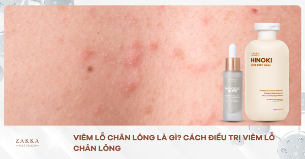 Viêm Lỗ Chân Lông Là Gì? Cách Điều Trị Viêm Lỗ Chân Lông
