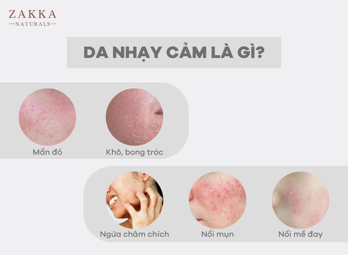 da nhạy cảm là gì