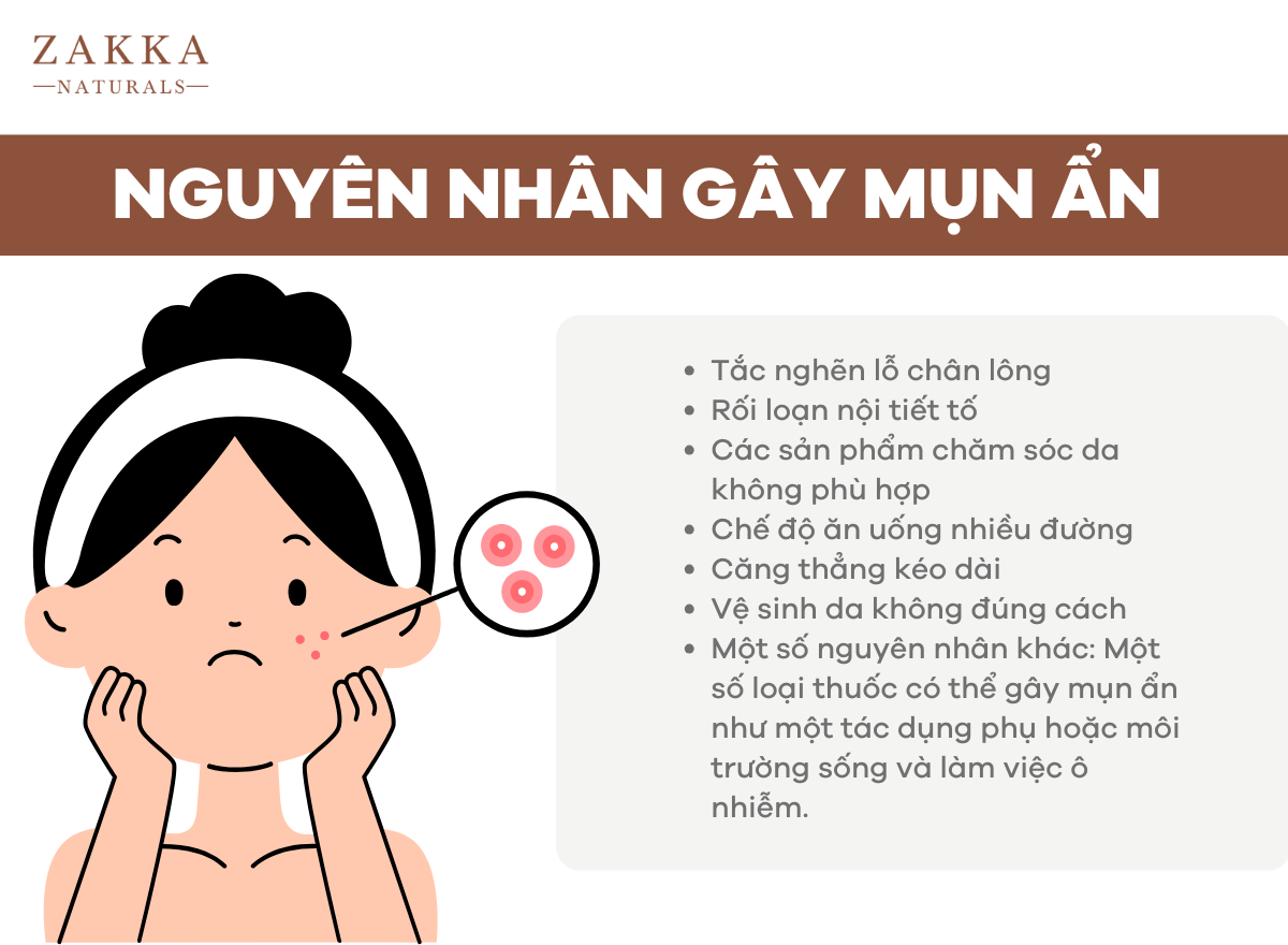 Mụn ẩn Là Gì? Cách Trị Mụn ẩn Từ Chuyên Gia