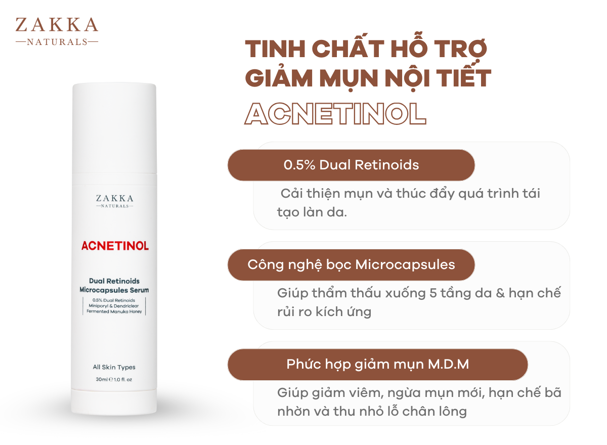 Mụn Nội Tiết Là Gì? Làm Sao Biết Mình Bị Mụn Nội Tiết