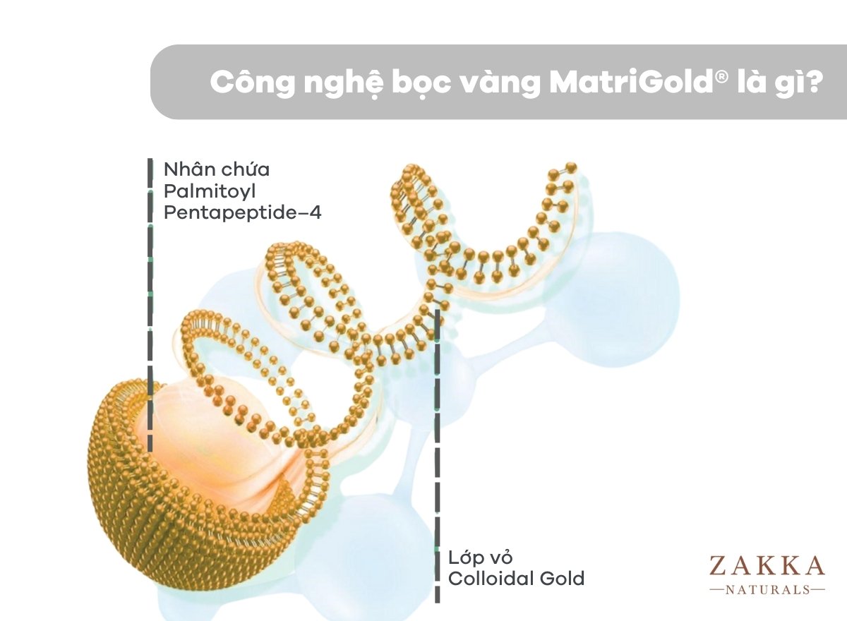 Công nghệ bọc vàng MatriGold®