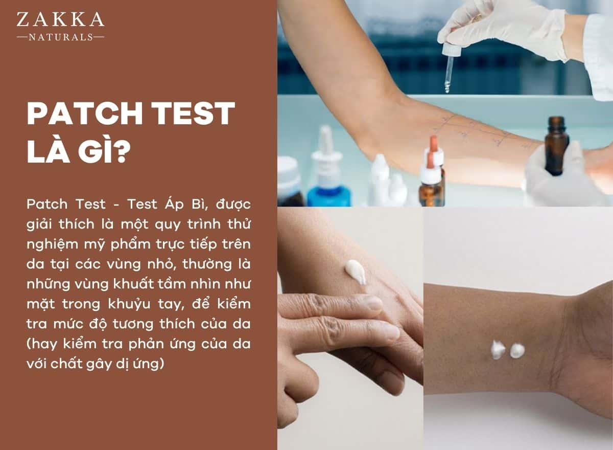 Các Loại Phản Ứng Trong Patch Test