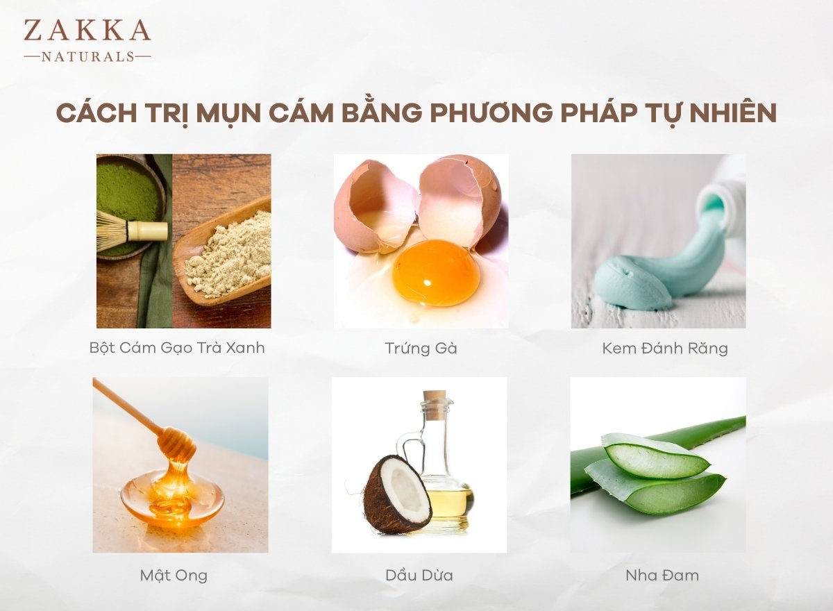 Mụn Cám Là Gì? Cách Trị Mụn Cám Tại Nhà