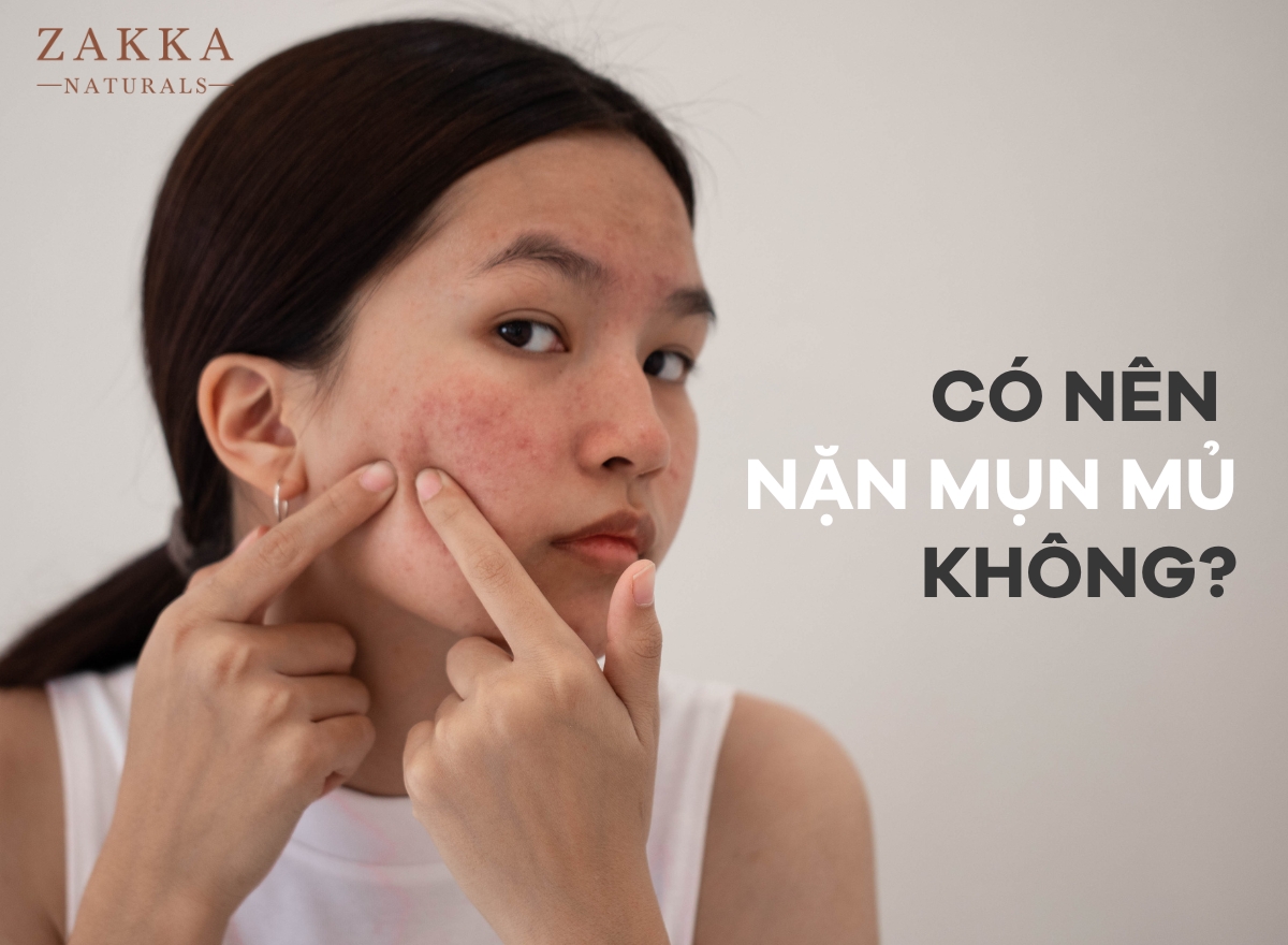Mụn Mủ Là Gì?