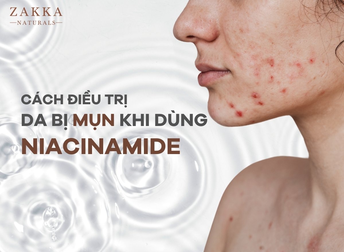 Dùng Niacinamide bị lên mụn