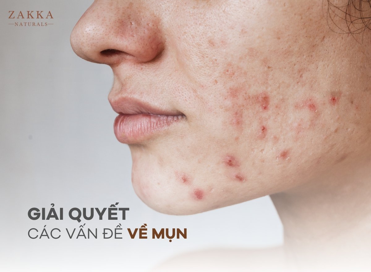 BHA có tác dụng gì? Vì sao BHA trở thành xu hướng làm đẹp được ưa chuộng?