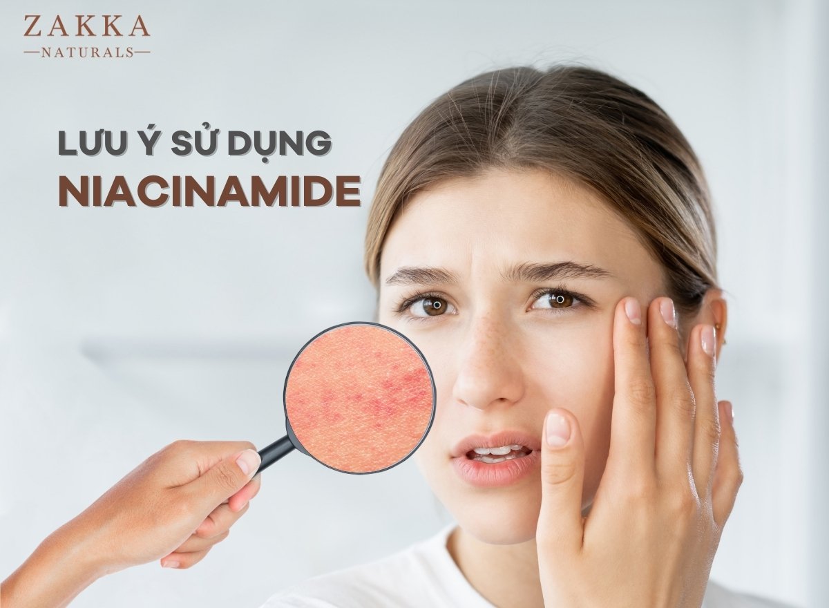 Dụng Niacinamide bị rát, khô da, châm chích phải làm sao