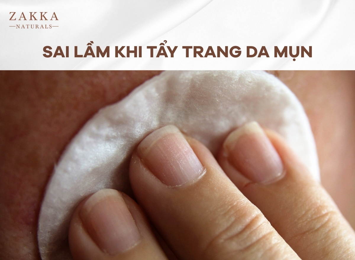 Hướng dẫn tẩy trang đúng cách cho da mụn sạch khỏe