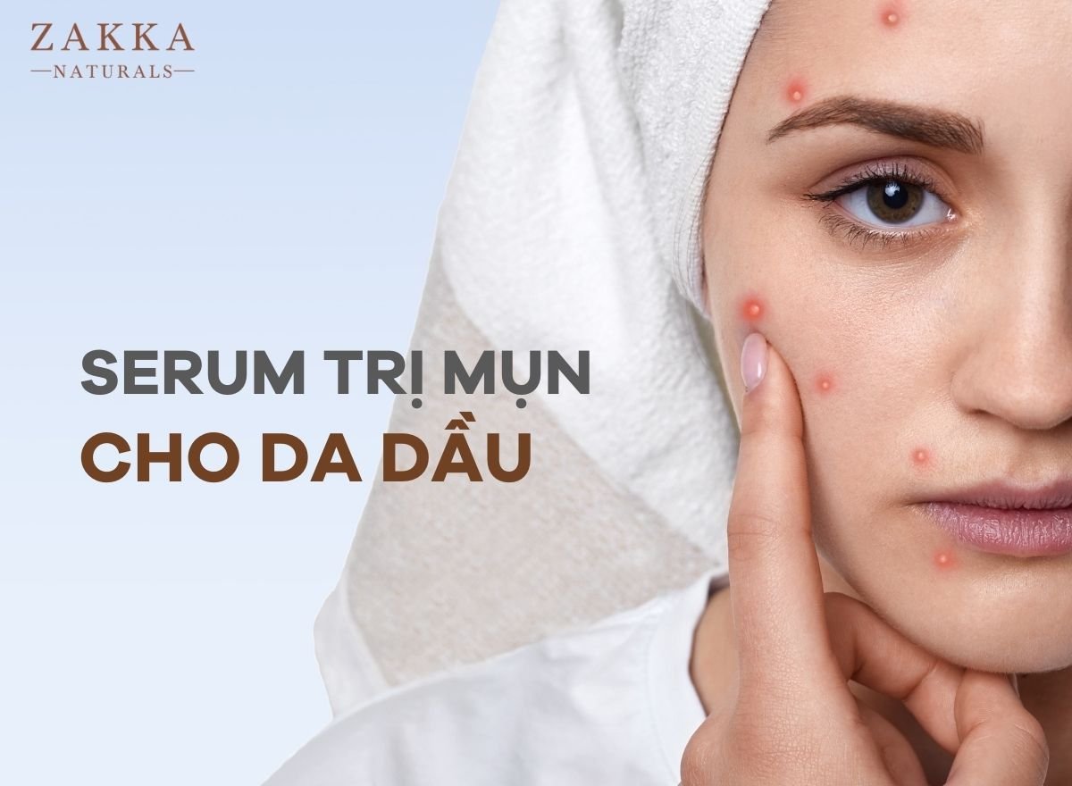 Bí Quyết Lựa Chọn Serum Cho Da Dầu Mụn