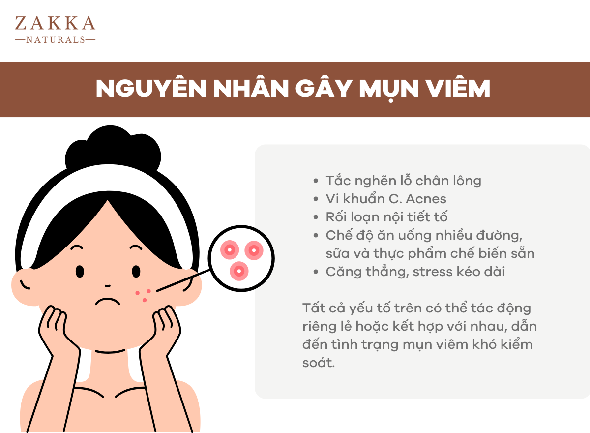 Mụn Viêm Là Gì? Cách Trị Mụn Viêm Từ Chuyên Gia